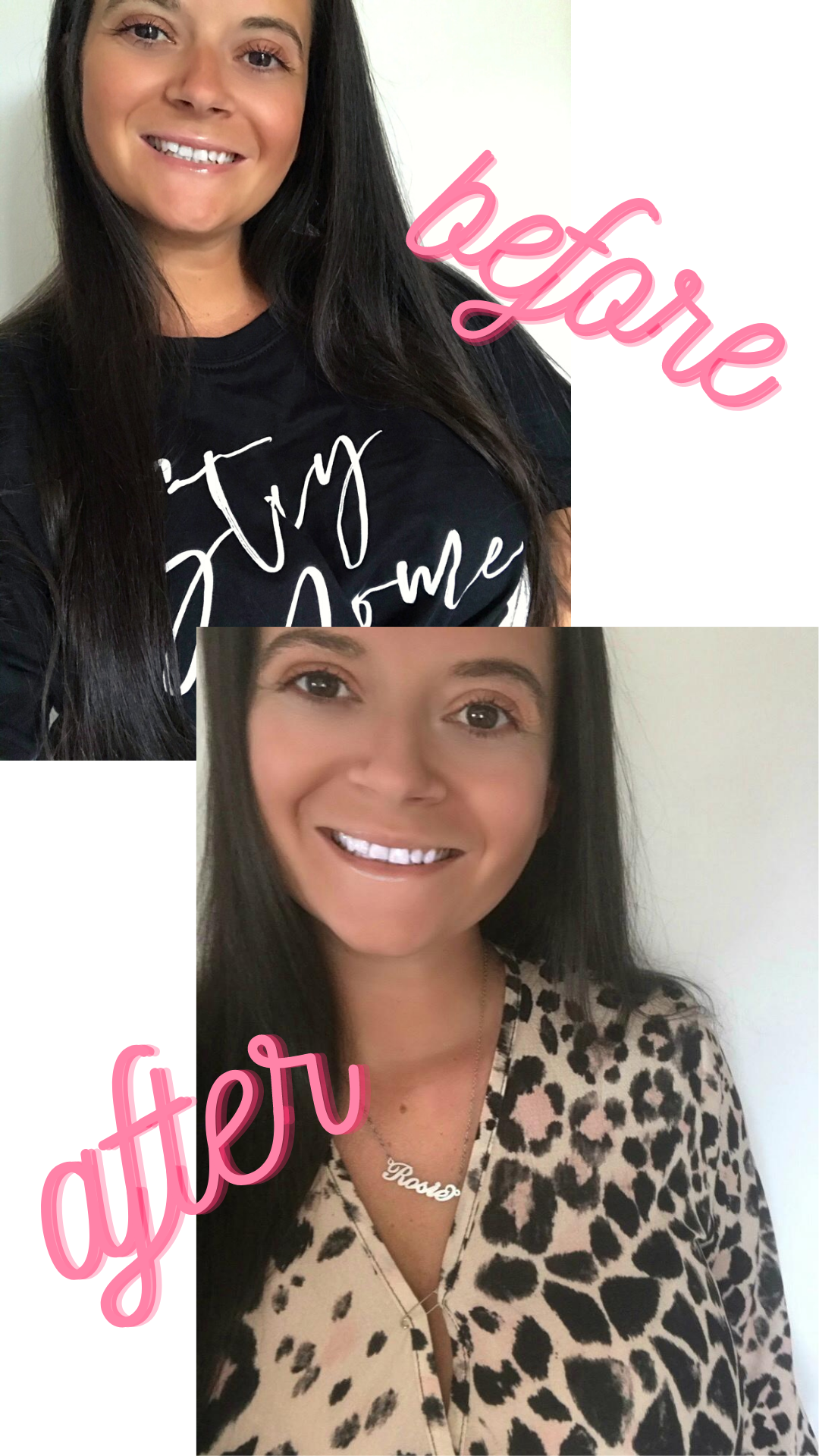 LoveRosiee showcases before and after photos of the Glo32 teeth whitening strips